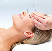 accupuncture